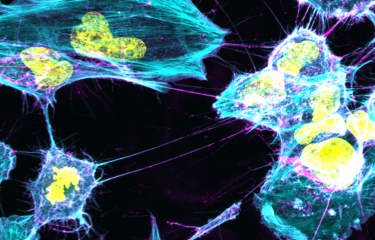 Les cellules microgliales humaines se connectent entre elles par l'intermédiaire de TNT. L'élément du cytosquelette, l'actine, est marqué en cyan, la membrane plasmique en magenta et les noyaux en jaune. © Institut Pasteur/Ranabir Ranabir CHAKRABORTY et C
