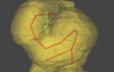 Reconstruction informatique de la forme du cœur embryonnaire montrant l'hélice 