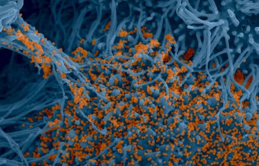 Coronavirus - SARS-CoV-2 - Institut Pasteur