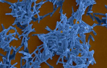Mycobacterium tuberculosis - Institut Pasteur
