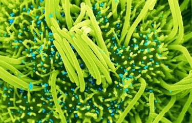 Human bronchial cells (green) infected with SARS-CoV-2 (blue) - Institut Pasteur
