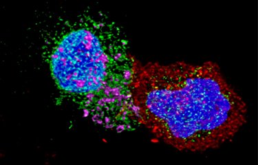 LTCD8 rentre en contact avec un LTCD4 infecté par le VIH - © Institut Pasteur