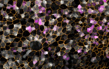 © Institut Pasteur/Nicolas Dray et Laure Mancini Photo de microscopie, illustration