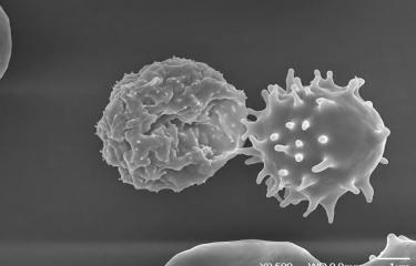 Globule rouge infecté par Plasmodium falciparum - © Institut Pasteur/Sylvie Perrot