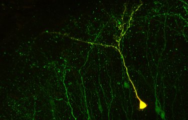 Néo-neurones dans un cerveau adulte - Institut Pasteur