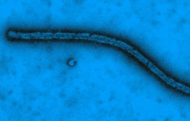 Virus Ebola vu en microscopie électronique à transmission - Institut Pasteur