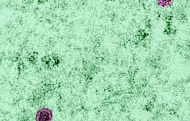  Cellules infectées par le virus du Zika en microscopie électronique à transmission - Institut Pasteur