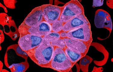 Parasite Plasmodium falciparum Institut Pasteur