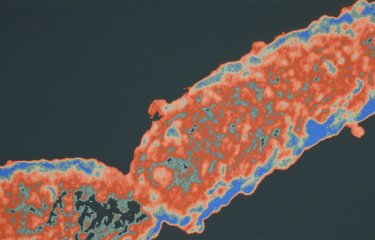 Coqueluche et autres bordetelloses - Institut Pasteur