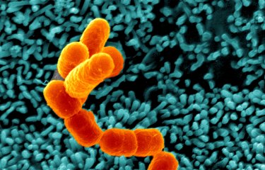 Escherichia coli, Shigella, Salmonella - Institut Pasteur