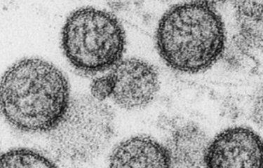Hantavirus - Institut Pasteur