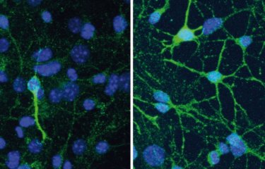 La dépression et l’efficacité des antidépresseurs dépendent de la composition du microbiote intestinal - Institut Pasteur