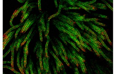 Récepteur cellulaire TMPRSS2 (en rouge) à la surface de cellules respiratoires ciliées (en vert) – Image obtenue par microscopie optique à haute résolution 