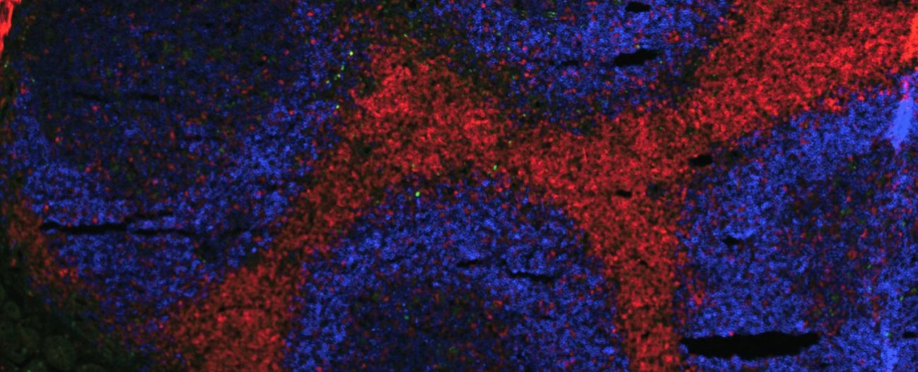 Plaques de Peyer vues du dessus. Il s'agit d'une population de lymphocytes qui "veillent "sur l'intestin