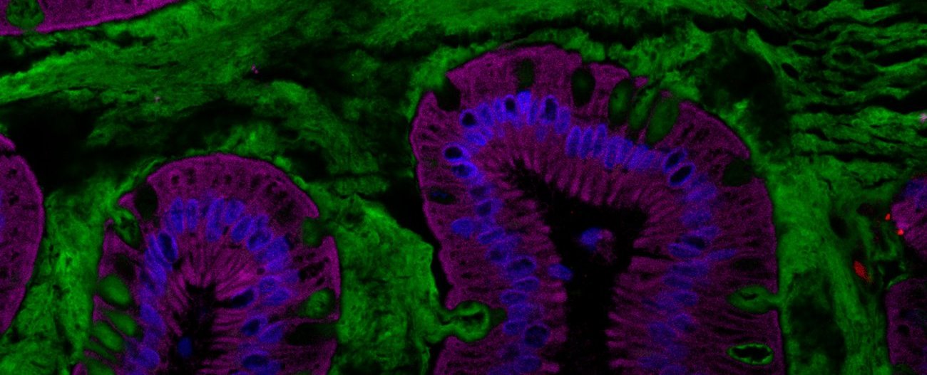 Coupe d’intestin humain représentant le microbiote intestinal