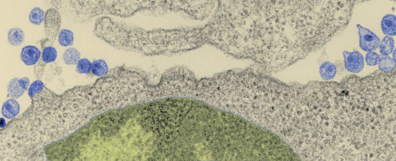 Sida / VIH : informations et traitements - Institut Pasteur