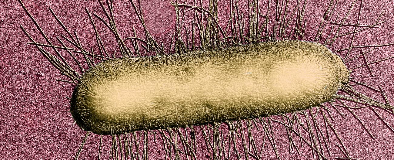 E. Coli - Institut Pasteur E. Coli - Institut Pasteur