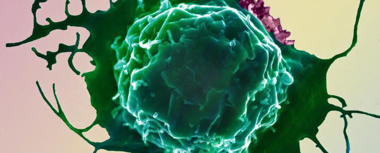 Biofilm HTLV-1 - Institut Pasteur 