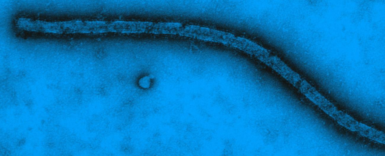 Virus Ebola vu en microscopie électronique à transmission - Institut Pasteur