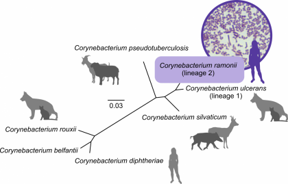 Diphtérie : une nouvelle espèce de bactérie est identifiée ...