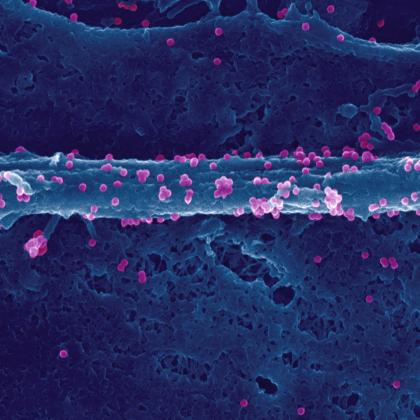 Virus chikungunya à la surface d'une cellule infectée - Institut Pasteur