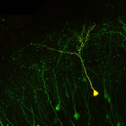 Néo-neurones dans un cerveau adulte - Institut Pasteur