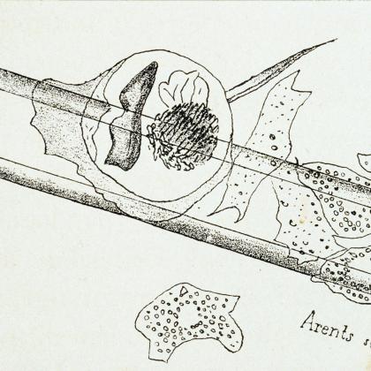 Travaux sur la phagocytose d'Elie Metchnikoff - Institut Pasteur