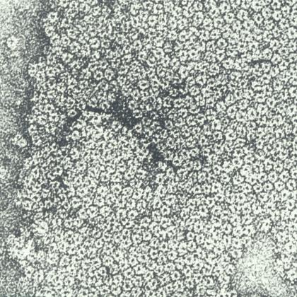 Récepteurs d'acétylcholine isolés et purifiés en 1970 par Jean-Pierre Changeux - Institut Pasteur