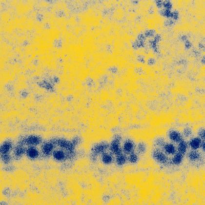 Virus de la fièvre jaune - Institut Pasteur